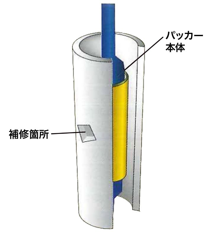 パッカーのセット